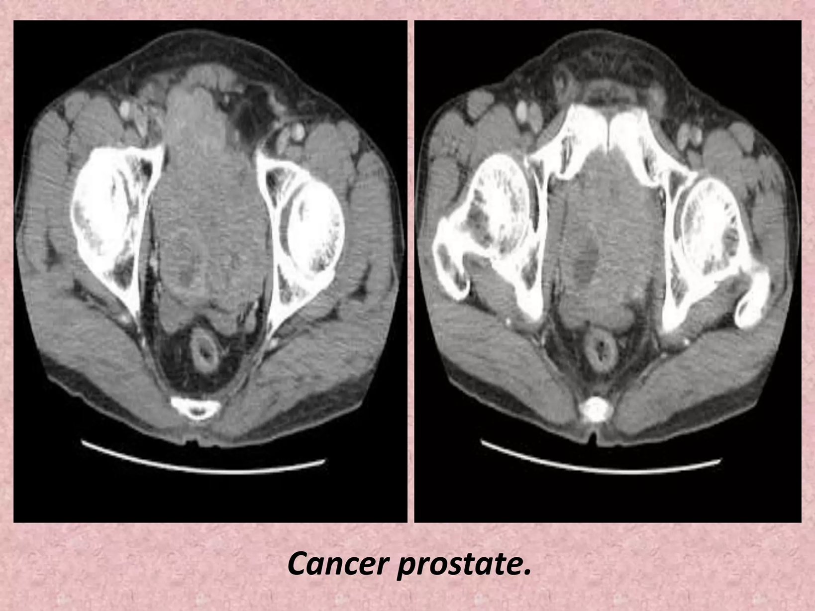 Nephrologist Care Nephrologist Care